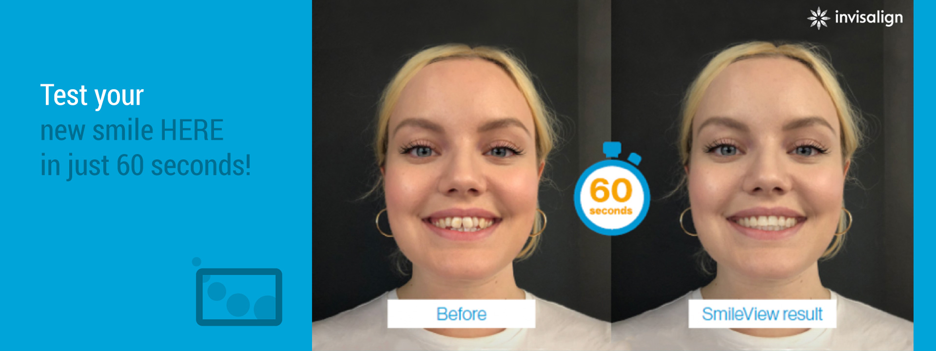 Smileview: Try your new smile in just 60 seconds