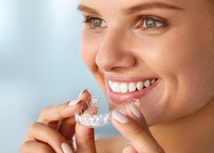 Invisalign - what is it ? The invisible clasp - a clear thing