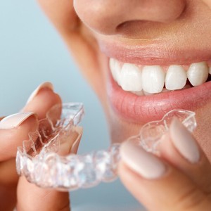 Invisalign - what is it ?